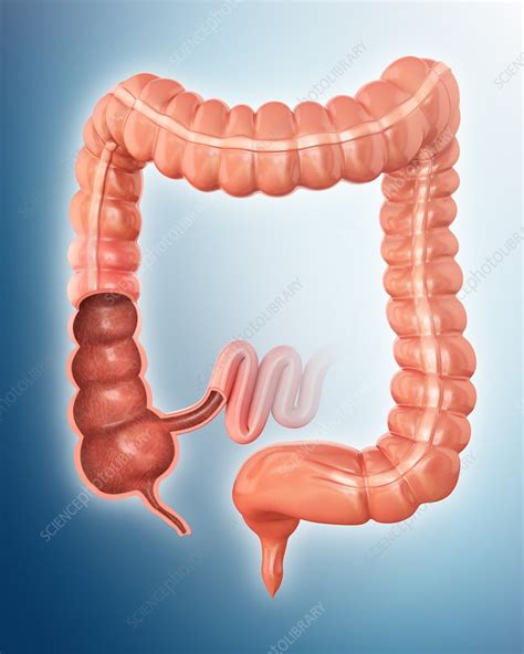 Large Intestine Illustration Stock Image F0122243 Science Photo Library