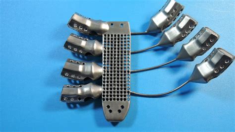 Spanish Cancer Patient Receives Worlds First 3d Printed Titanium Rib Cage