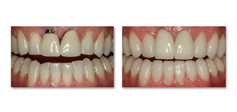 Gold coast dental studio is proud to provide a full catalogue of family, general, restorative and cosmetic dentistry services for patients of all ages. ORA Dental Studio | West Loop • South Loop • Wicker Park • Gold Coast - Chicago, IL