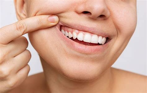 From Pearly Whites To Strong Gums Heres What Healthy Teeth Truly Look