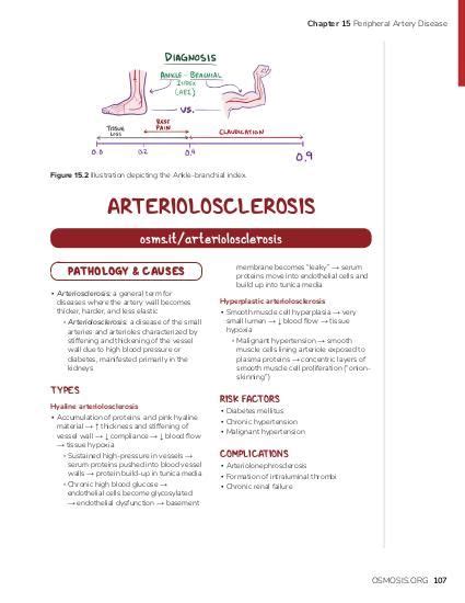 Peripheral Artery Disease Osmosis