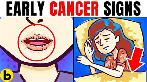 11 Early Cancer Warning Signs That You Shouldnt Ignore Youtube