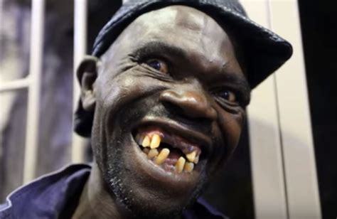 Zimababwe Crowns Its Ugliest Man In A Pageant Complex