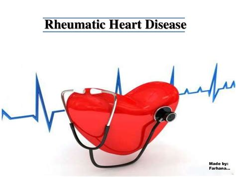 Rhdrheumatic Heart Disease