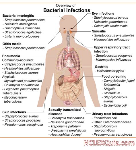 Overview Of The Bacterial Infections Chart Nclex Quiz
