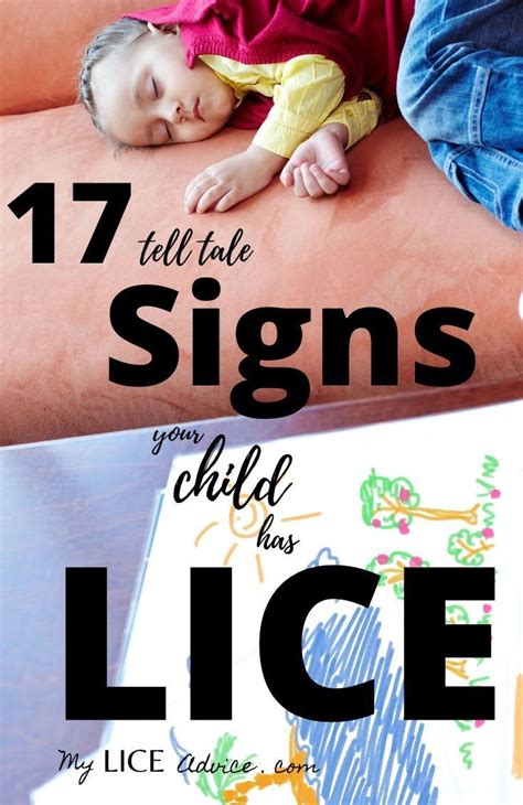 17 Lice Symptoms With Pictures Signs That You Have Head Lice In 2020