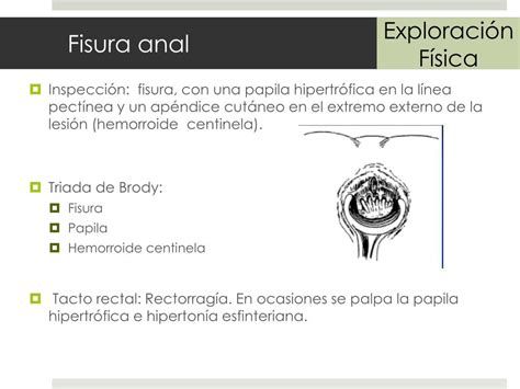 Ppt Patología Anorrectal Powerpoint Presentation Free Download Id2250702
