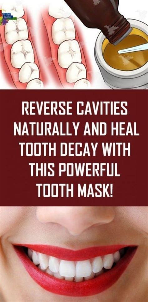 How To Reverse Tooth Decay Ayurveda How To Heal Tooth Decay And