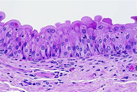 Transitional Epithelium Of Human Bladder Magnification X100 H And E
