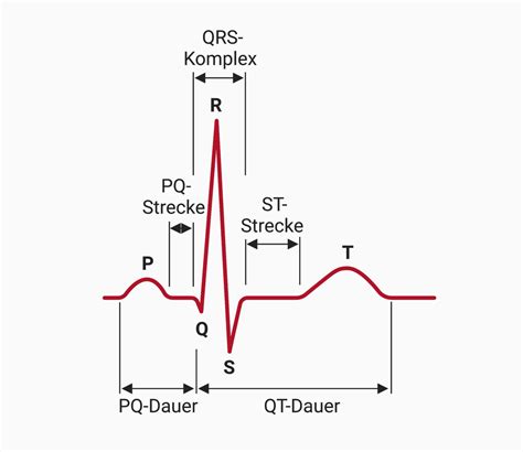 EKG: Sinusrhythmus - DocCheck