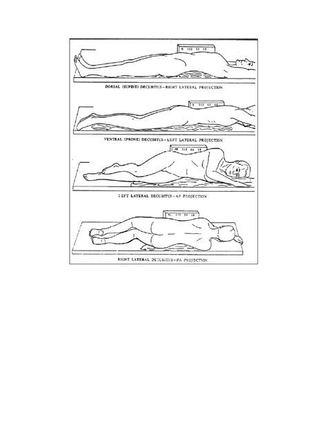 Figure 2 41 Decubitus Position Fluoroscopy And Special Radiographic