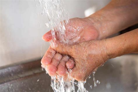 چگونه سوختگی دست را درمان کنیم؟