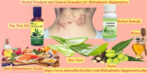 Herbal Products And Natural Remedies For Hidradenitis Suppurativa