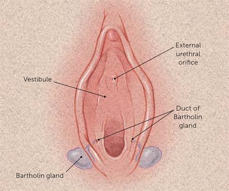 Bartholin Duct Cyst And Gland Abscess Office Management AAFP
