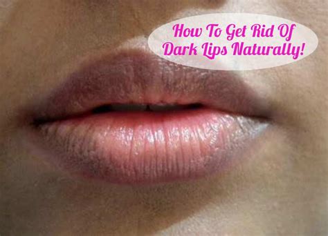 How To Get Rid Of Dark Lips Naturally How To Lighten Your Lips