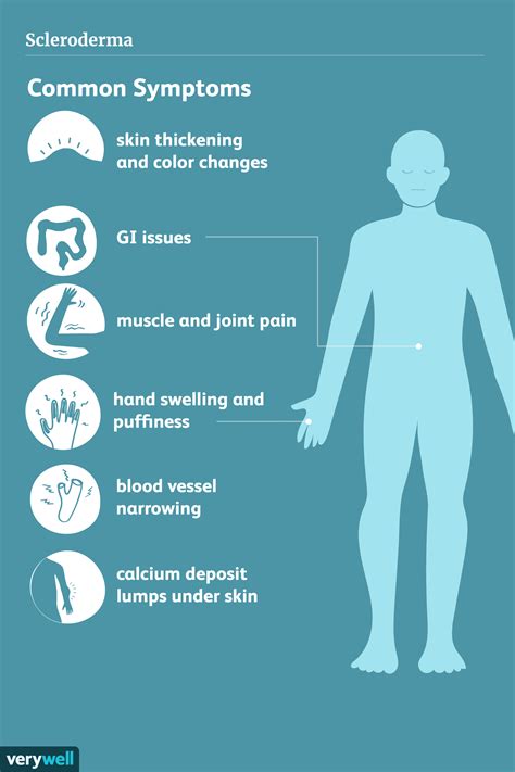 Scleroderma Signs Symptoms And Complications