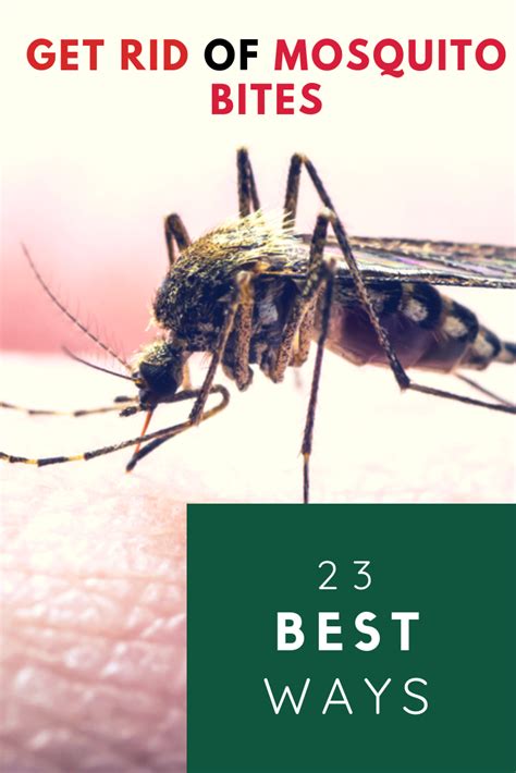 How To Get Rid Of Mosquito Bites 23 Of The Best Ways With Images