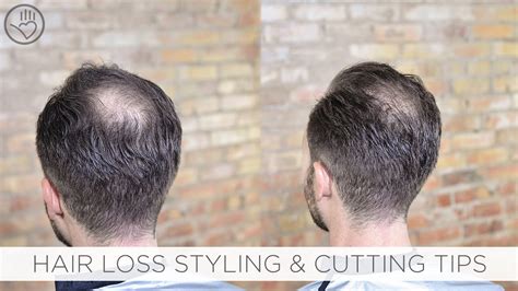 This look, combined with a slight undercut, can. How To Cut & Style Balding or Thinning Hair - YouTube