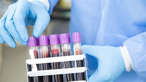 desarrollan primera prueba de sangre que detecta 50 tipos de cáncer