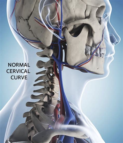 Reverse Cervical Curve Charlotte Chiropractic Center Pllc