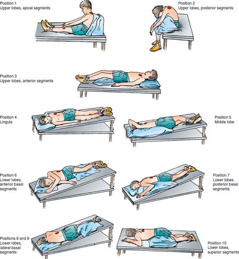 Percussion And Postural Drainage Positions In Bronchiectasis Best