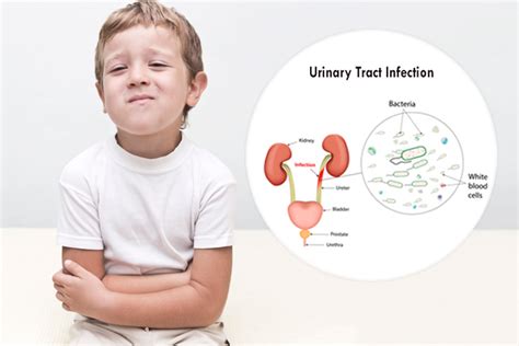 Urinary Tract Infection Uti In Children Symptoms And Home Remedies