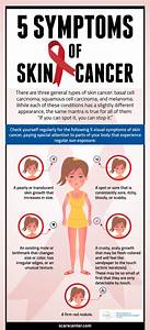 5 Symptoms of Skin Cancer by skarscenter16 on DeviantArt Skin Cancer  