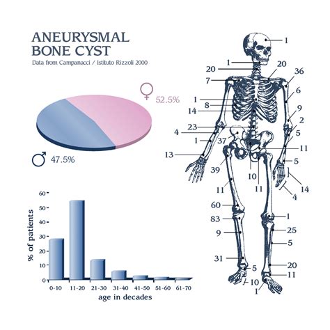 Aneurysmal Bone Cyst