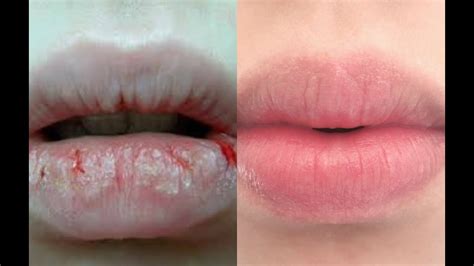 best ways to exfoliate lips