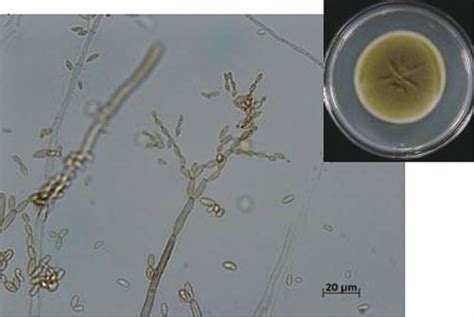 Cladosporium Cladosporioides Cladosporium Is A Common Fungus