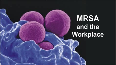 Mrsa And The Workplace Youtube