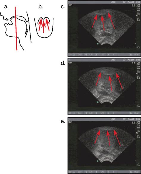Ultrasound Imaging Of The Tongue A Schematic Midsagittal Vocal Tract