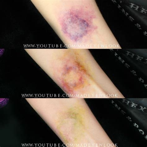 Different Healing Stages Of Bruises Makeup Tutorial On Fx Makeup