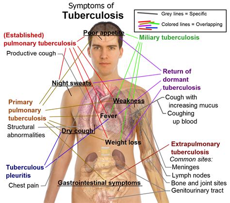 Rachel Lanoue S HSC4233 Blog Tuberculosis What Is It Exactly