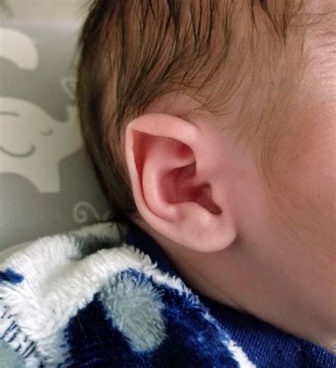 My Son Was Born With Natural Elf Ears Rmildlyinteresting