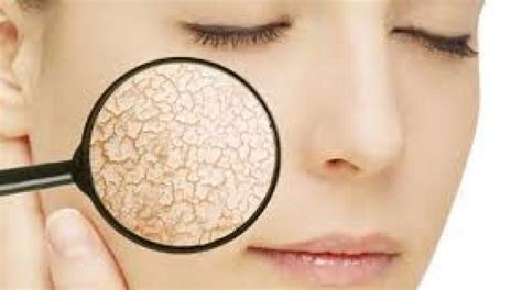 Top 5 Fairness Tips For Dull And Dry Skin Stylepk