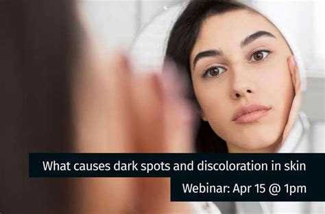 Reviva Labs April 15 2020 Webinar What Causes Dark Spots And