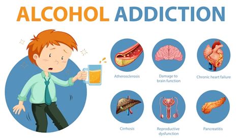 Free Vector Alcohol Addiction Or Alcoholism Information Infographic