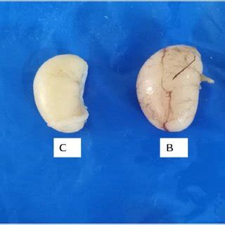 Photograph Showing Normal Testes A And Testicular Atrophy In Download Scientific Diagram