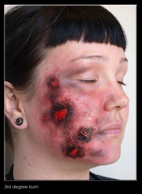 31 Days Of Halloween Makeup Day 6 How To Create A 3rd Degree Burn