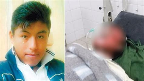 La Muerte De Un Joven Que Fue Quemado Por Pandilleros Indigna A Bolivia