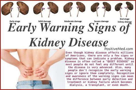 Kidney Disease Warning Signs Kidney Disease Diet Chronic Kidney