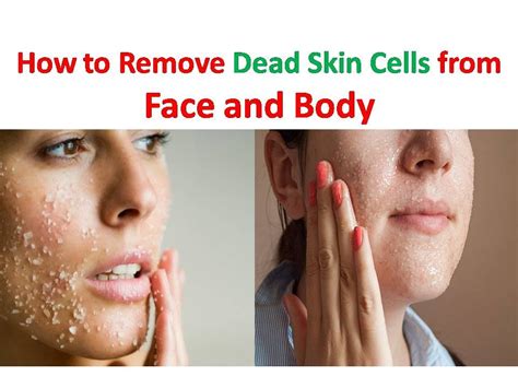 Home Remedy For Dead Skin Cells How To Get Rid Of Dead Skin Cells