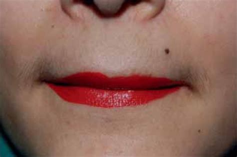 Rolling Of Lips To Spread The Lipstick Download Scientific Diagram