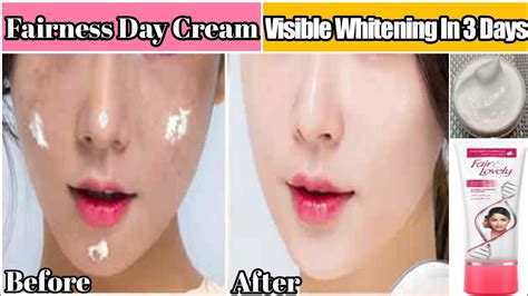 Best Skin Whitening Day Creamget Visible White And Clear Skin In 3 Days