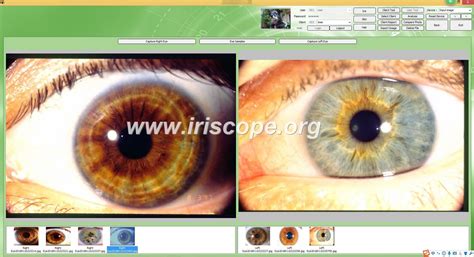 Digital Iriscope Iriscope Iridology Camera Iriscope Camera