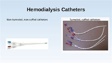 Hemodialysis Catheters How To Keep Yours Working Well — Teletype