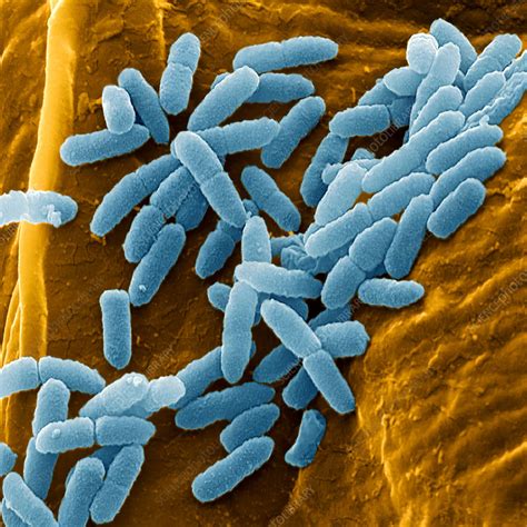 Pseudomonas Aeruginosa Bacteria Sem Stock Image B2201679 Science