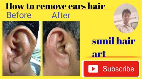 How To Remove Ears Hair Youtube