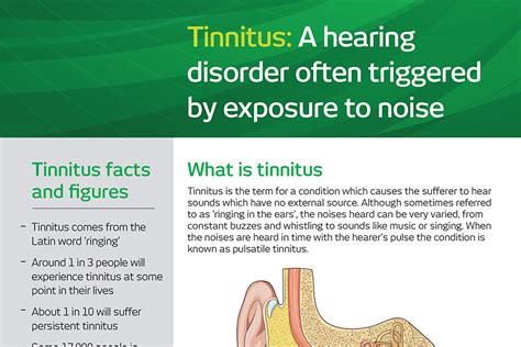 Understanding Tinnitus White Papers Rvt Group